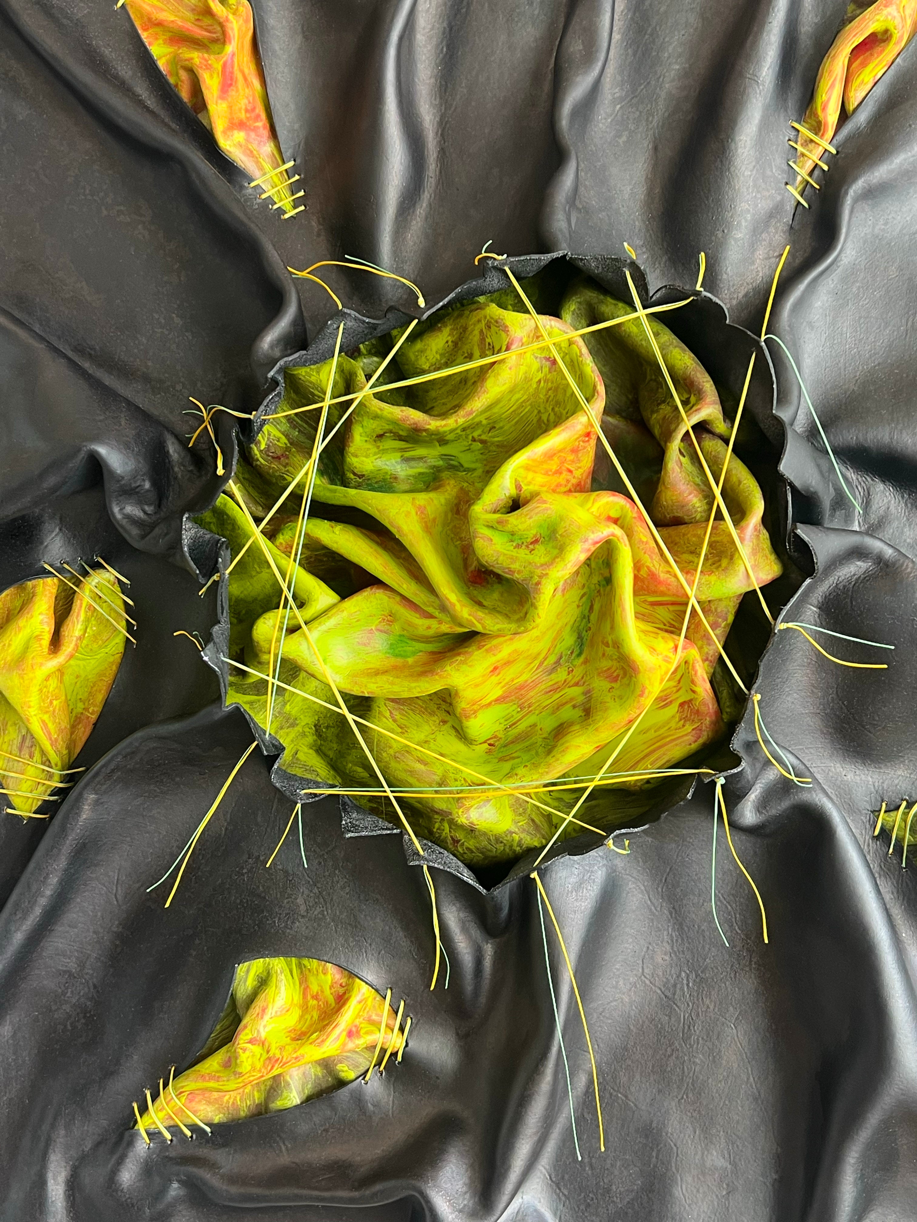 My Intrusive Thoughts Are Winning